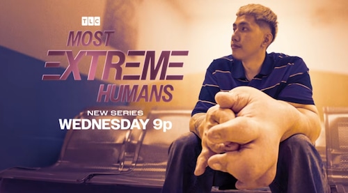 TLC Debuts Rare-Condition Medical Series - How To Watch