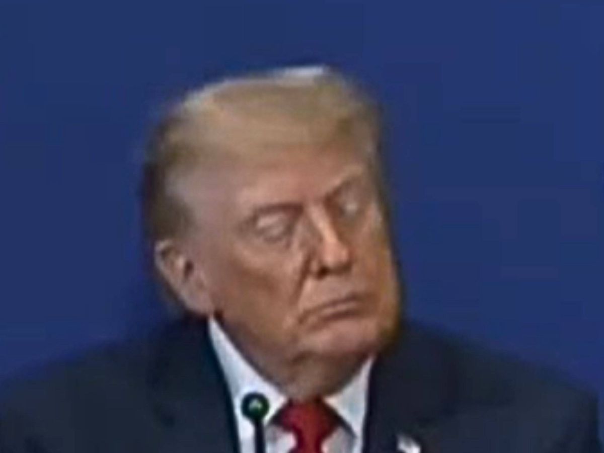 Health Concerns Grow as Trump Appears 'Barely Conscious' on Air