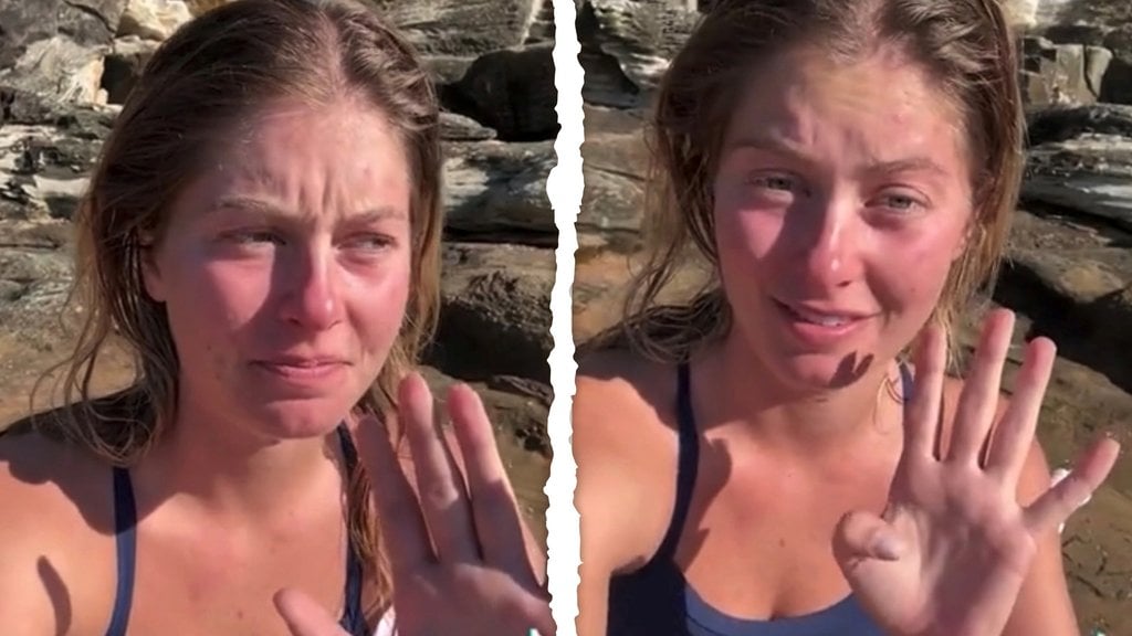 TV Star Faces Backlash Over Insensitive Shark Attack Video