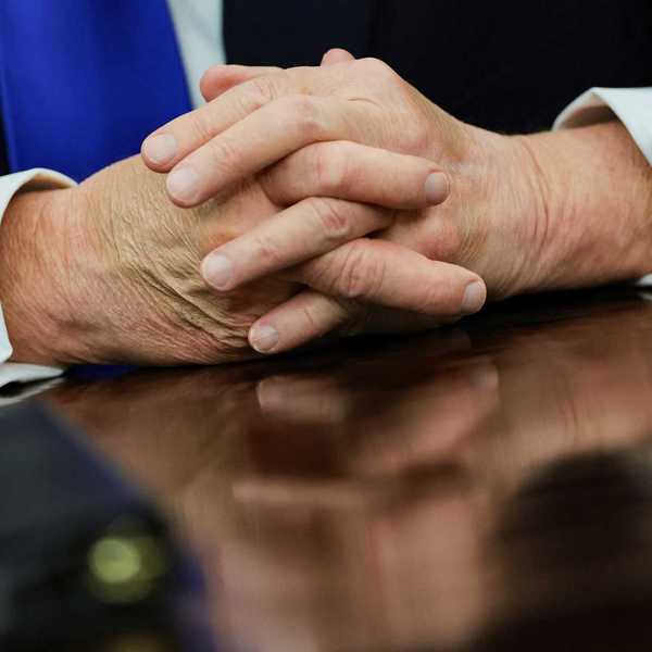 White House Says Little As Trump’s Bruised Hands Raise Questions