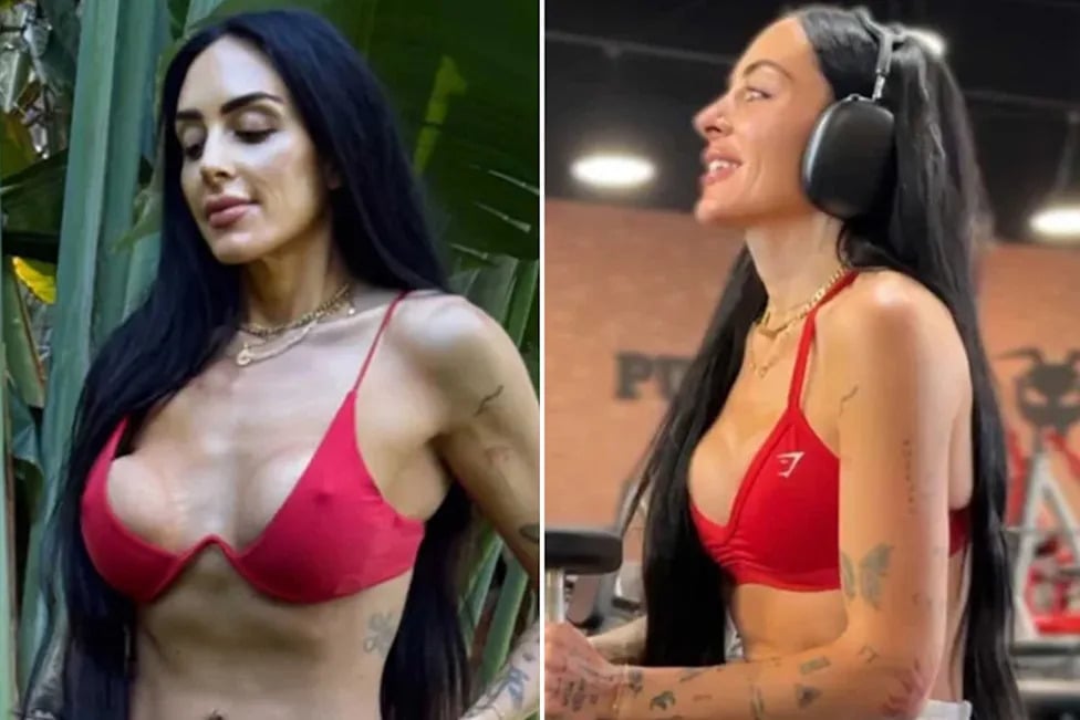 I Survived Two Botched Boob Jobs - Why I Have No Regrets
