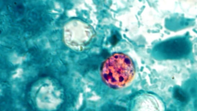 Parasite Outbreak in Florida Triggers Health Alert